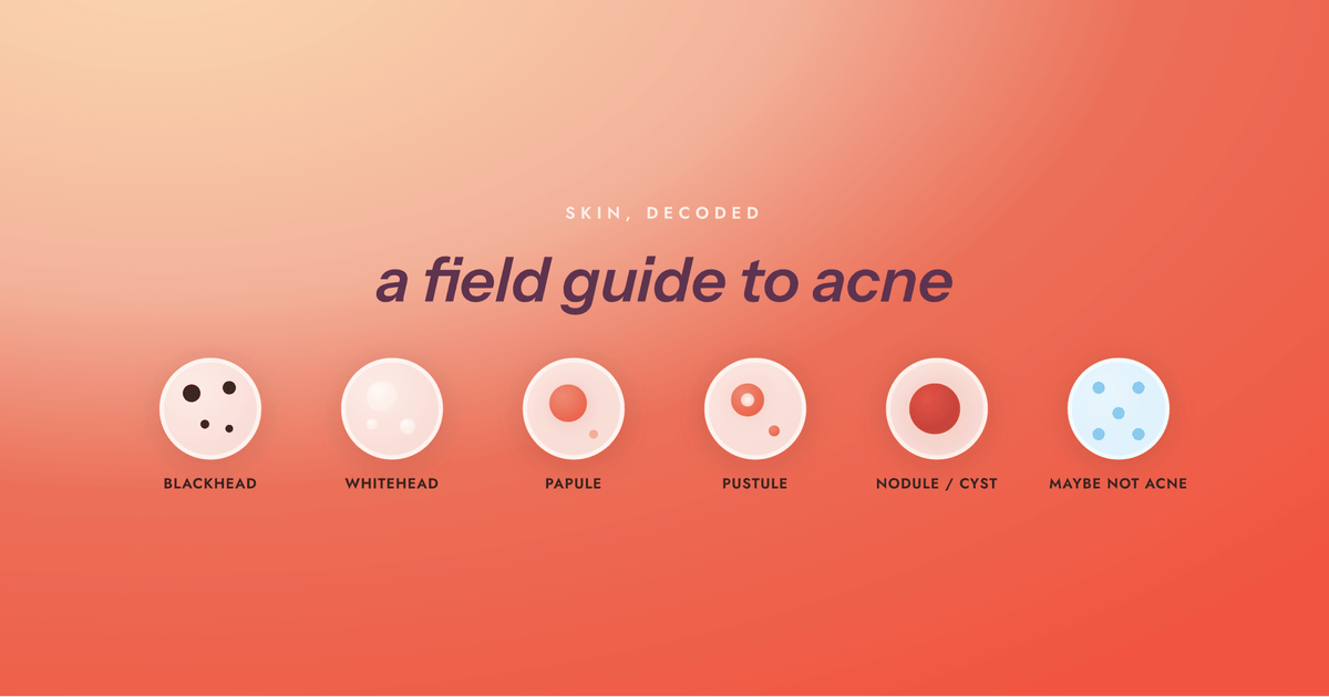 The Types of Acne, Explained
